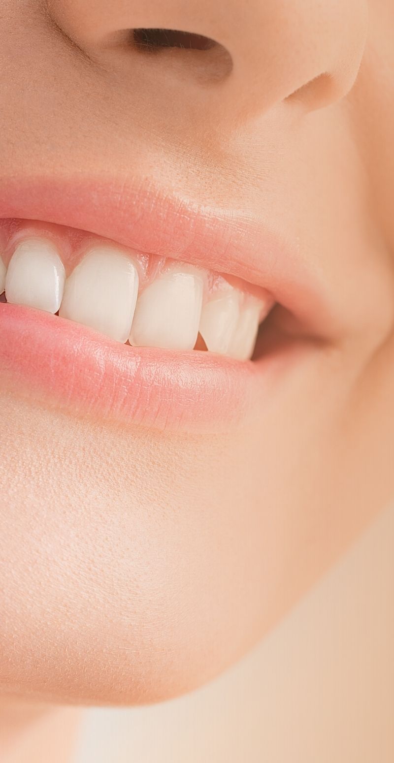bocasorriso Boca Sorriso